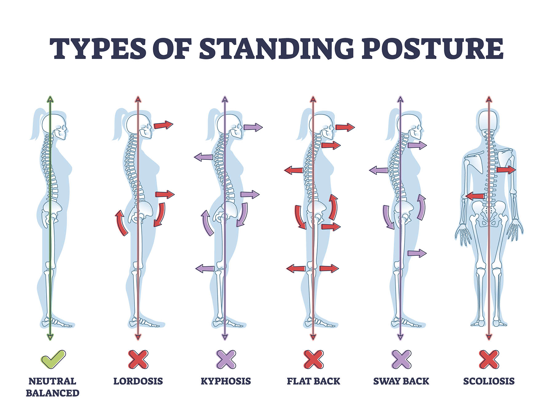 Importance of Posture in Lifting and Everyday Life.